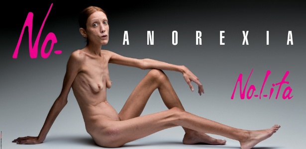 Campanha contra a anorexia estrelada por Isabelle Caro, morta em novembro de 2010. A foto é de 24/9/07 - Reuters
